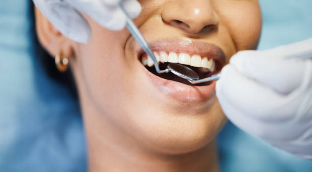 Best Emergency Dental Services for Seniors in Alderwood Manor, WA
